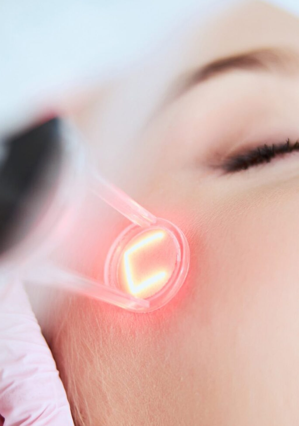 Lasers en médecine esthétique