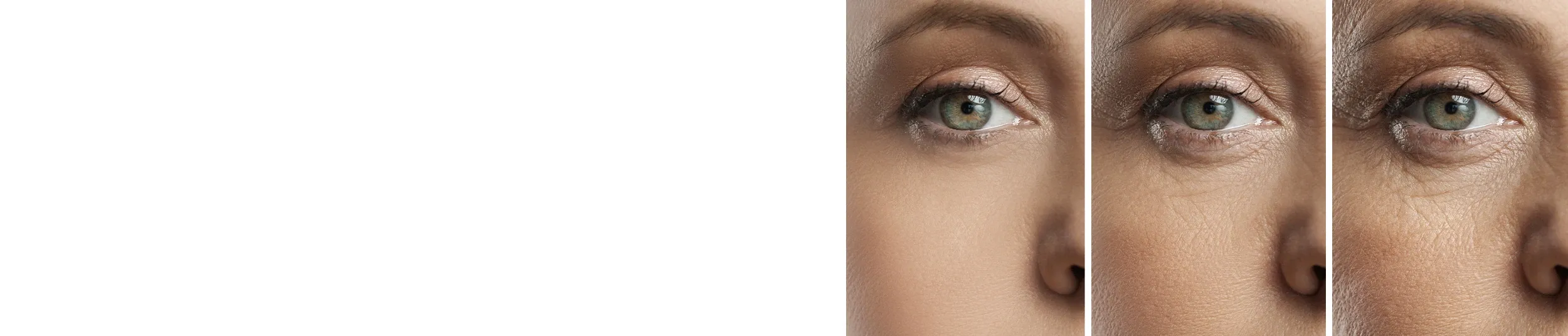 Blépharoplastie médicale Saint-Jean-de-Luz